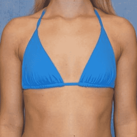 Royal Bee Pollen 1 Month Result